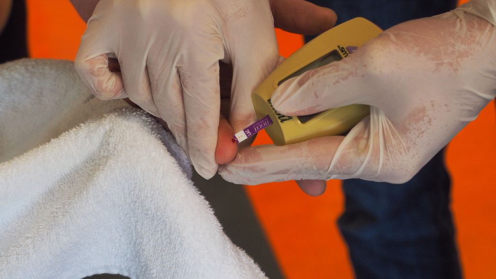 click to enlarge Il classico prelievo per determinare la concentrazione di lattato nel sangue